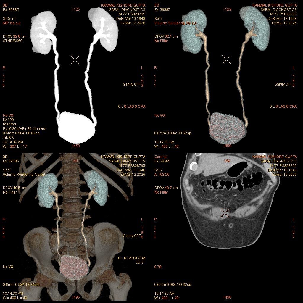 Urography (Scan Chages Only)