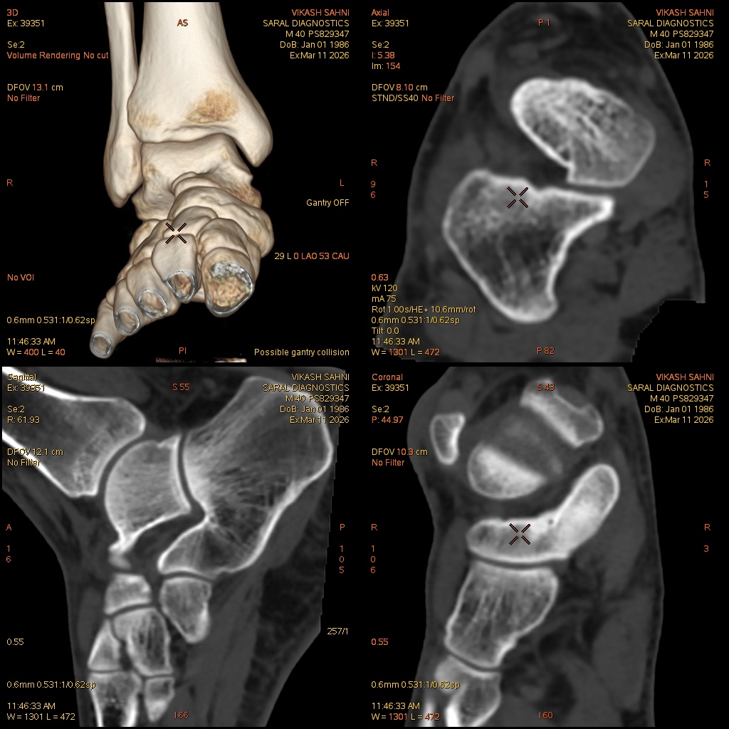 Left Ankle (Scan Charges Only)