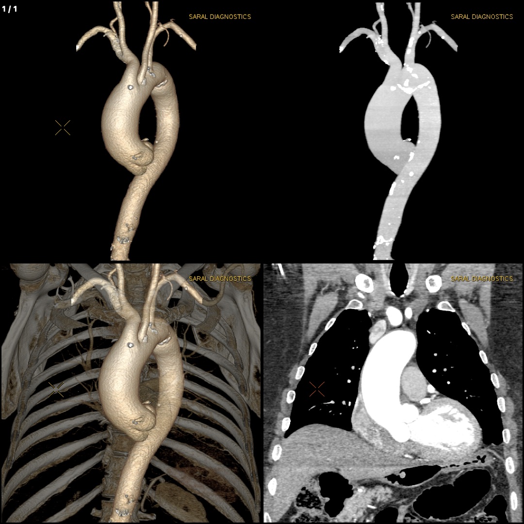 Thorax with Cardiac Gating (Scan charges only)