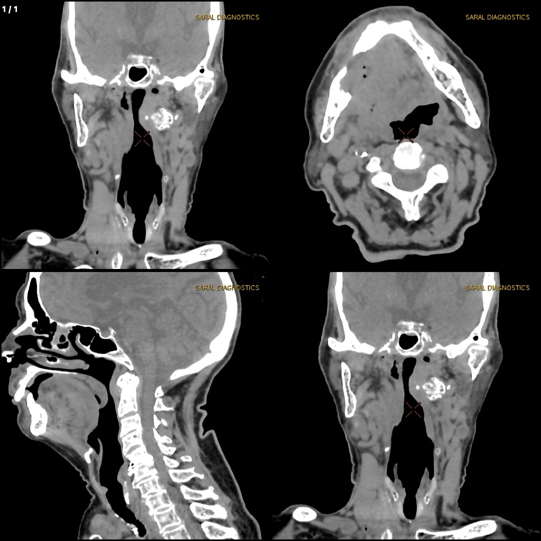 Neck (Scan charges only)