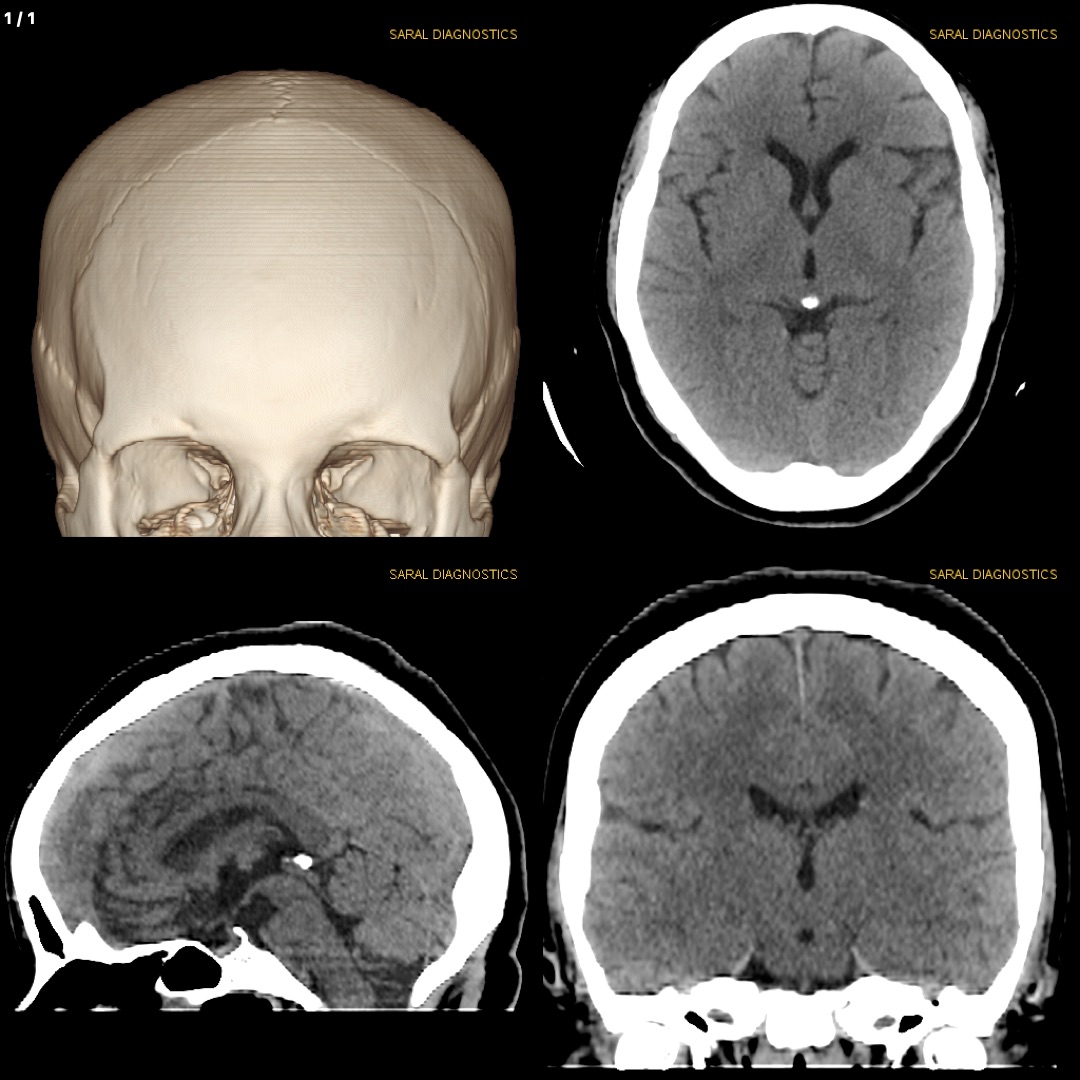 Head Plain (Scan charges only)