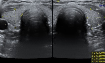 Neck / Thyroid