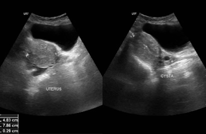 Lower Abdomen / Pelvis
