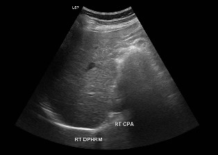 Chest/Thorax