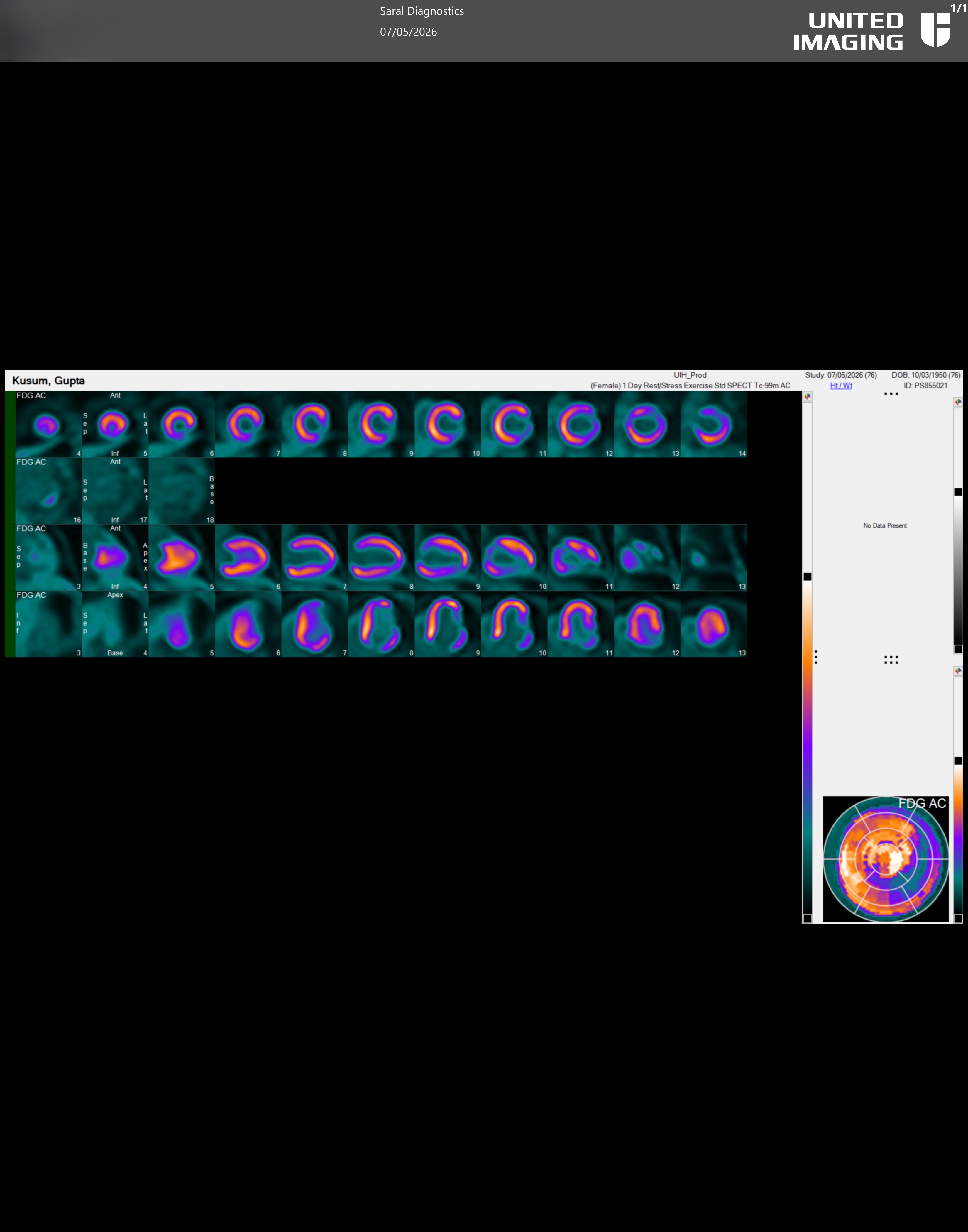 FDG-Cardiac