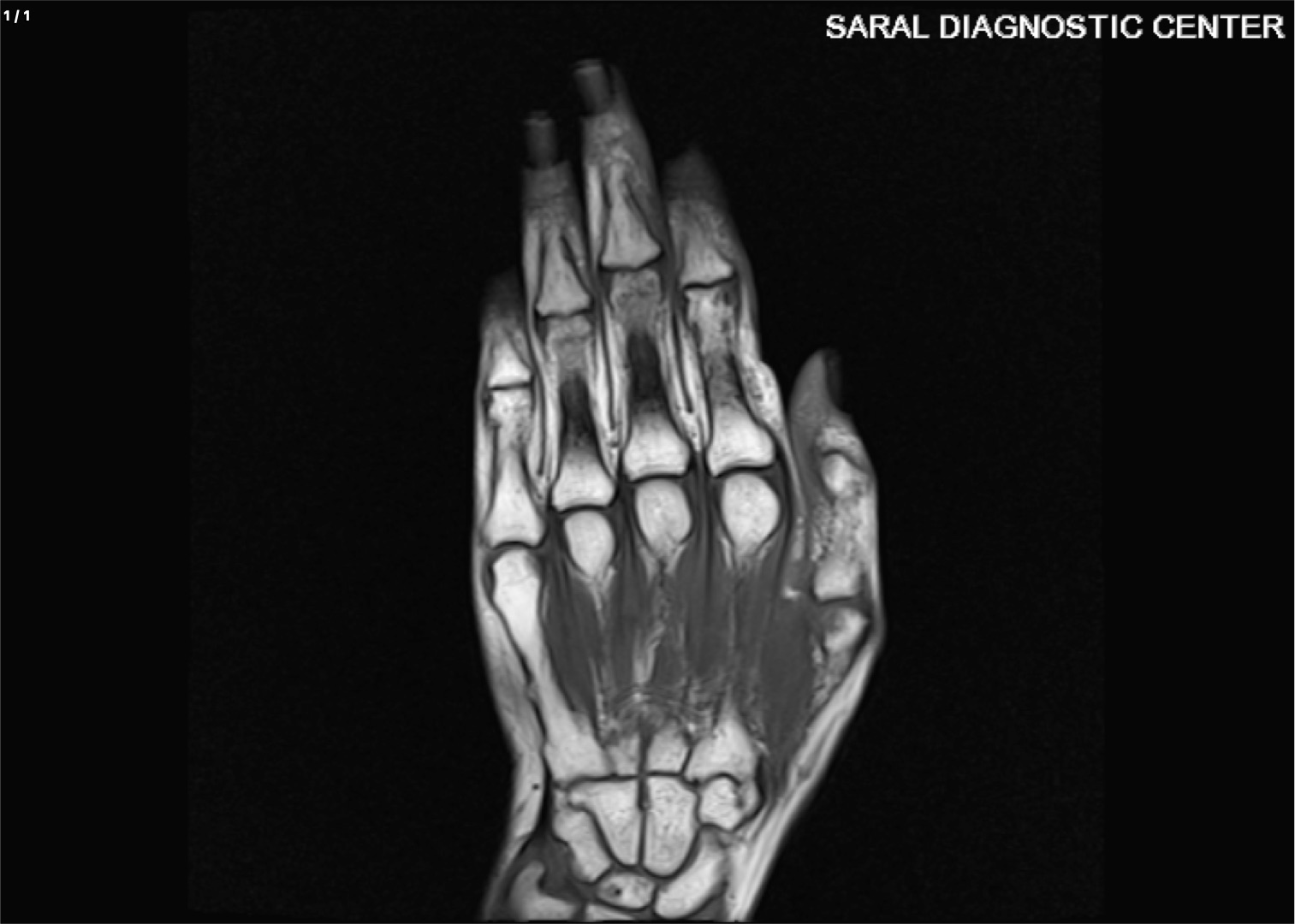 Hand- Right with contrast
