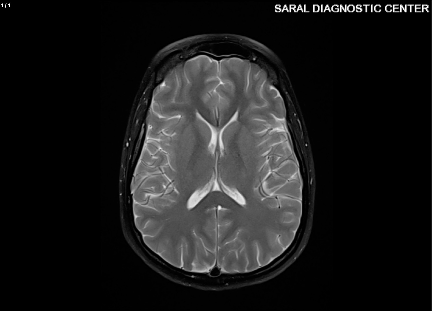 Head Contrast / Brain Contrast