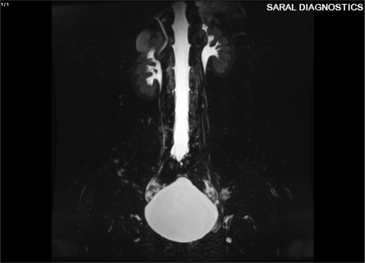 KUB / UROGRAPHY / PYELOGRAPHY