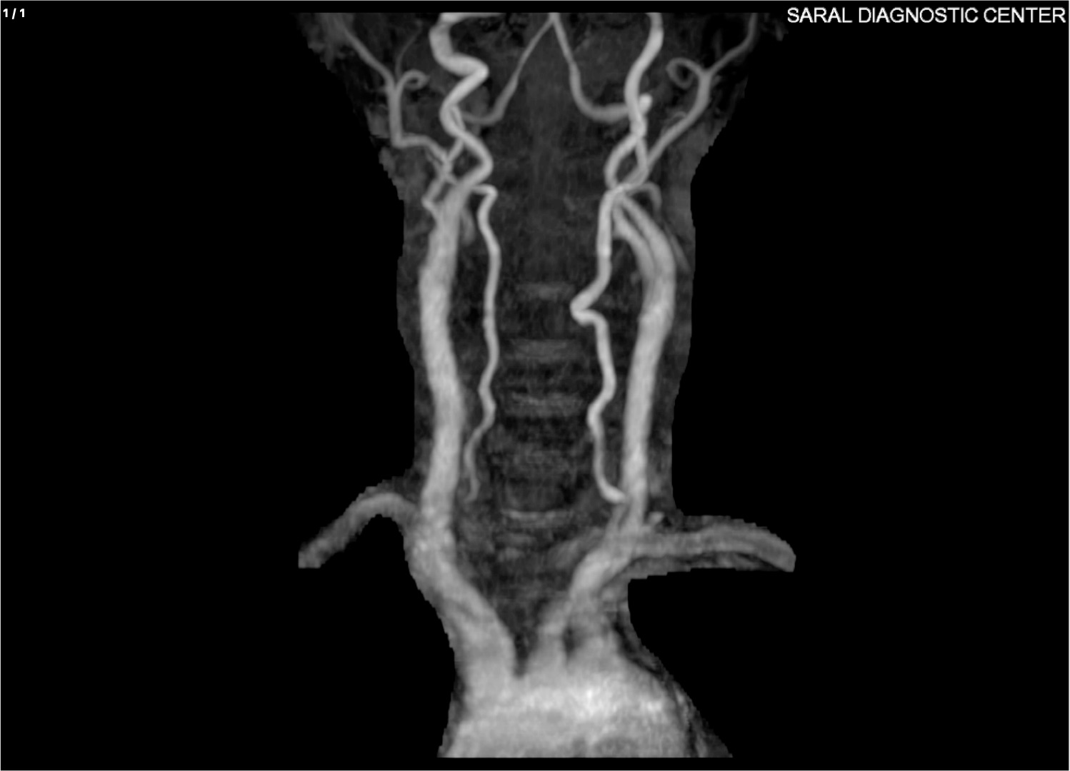 Angio NECK
