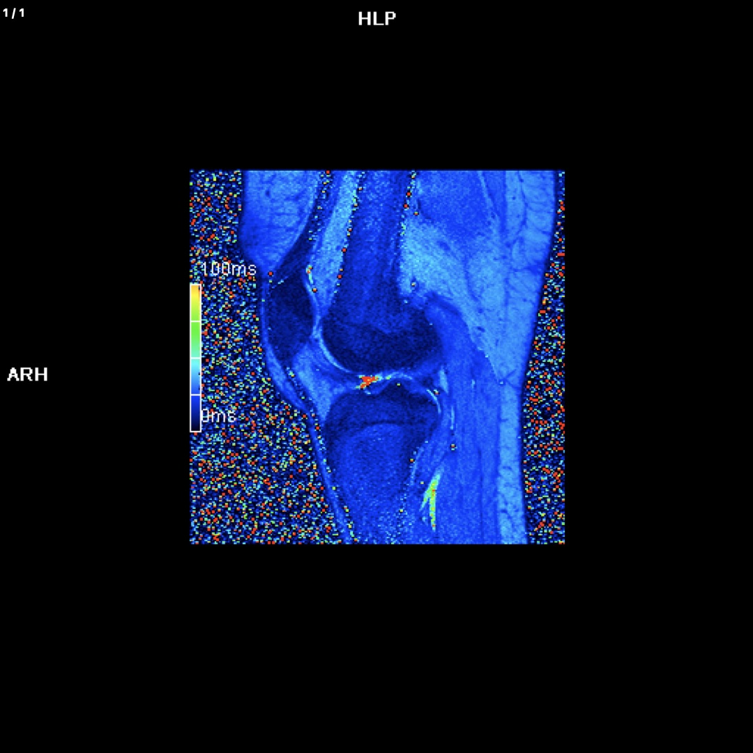 Cartigram Right