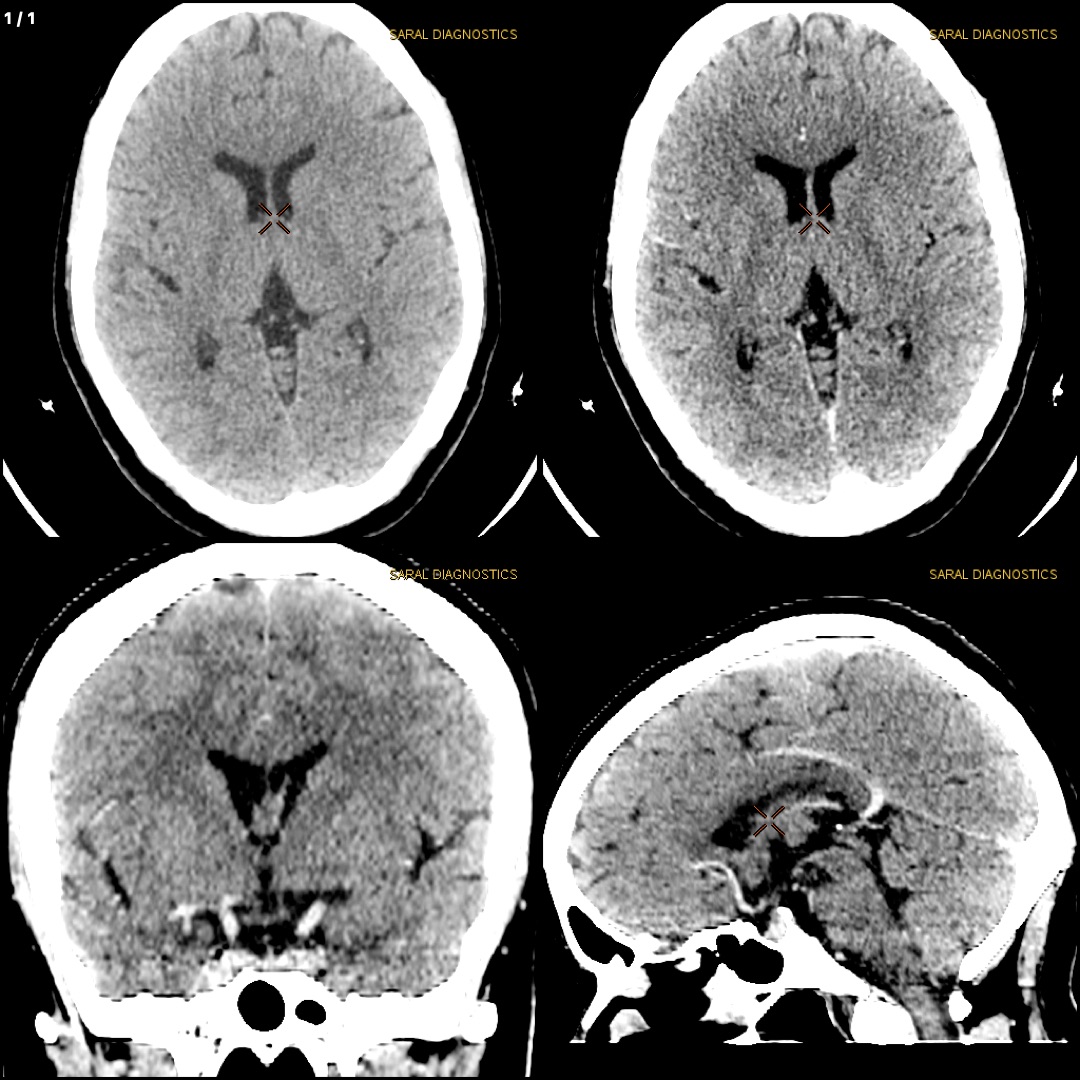Head Plain & Contrast (Scan charges only)